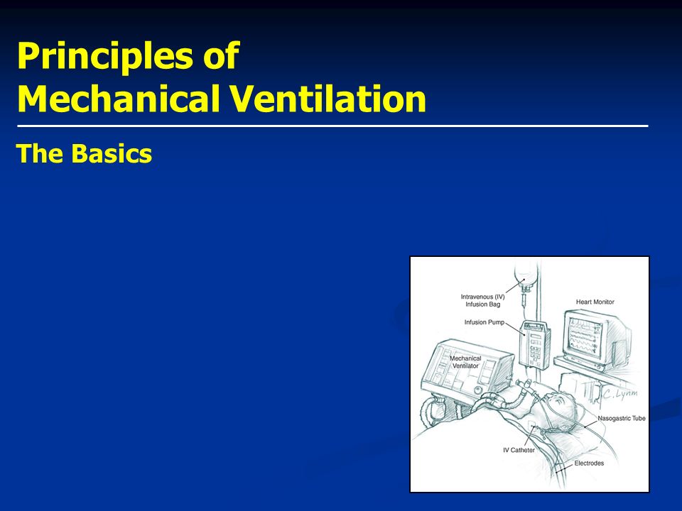 Principles Of Mechanical Ventilation Ppt Video Online Download