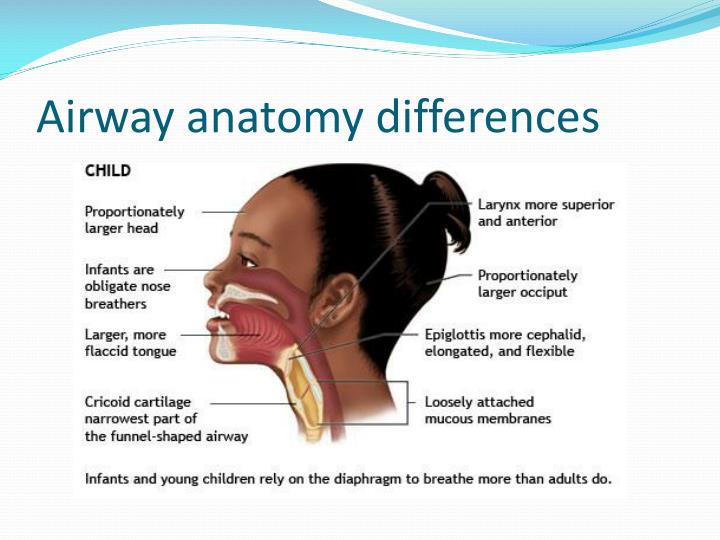 Pediatric Airway Differences