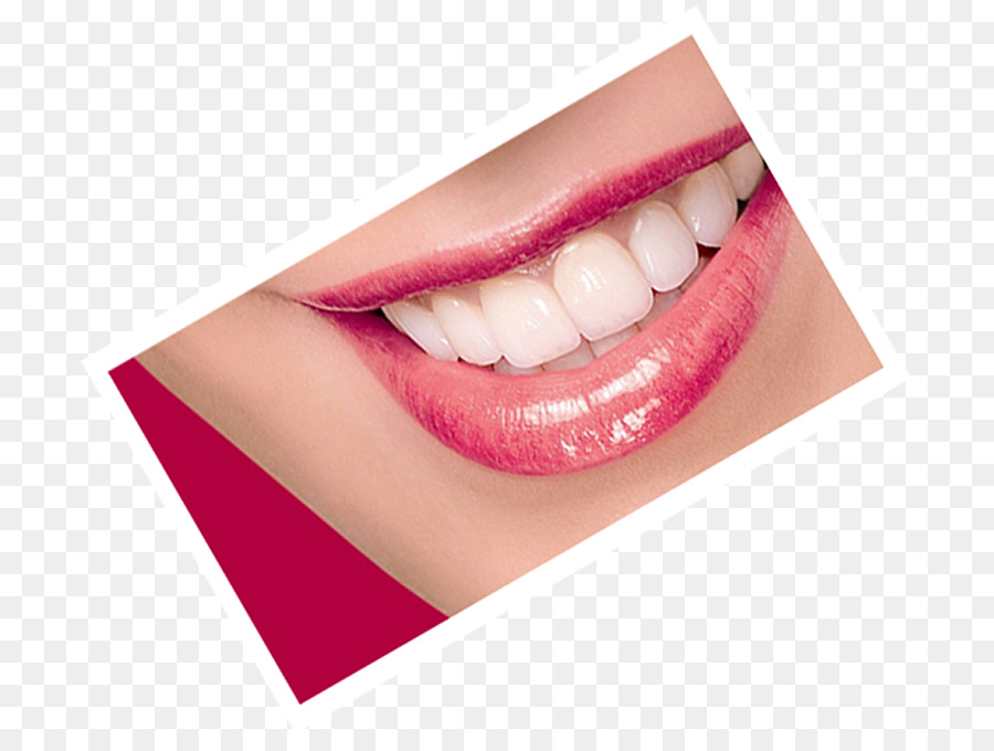 Dent，La Dentisterie PNG