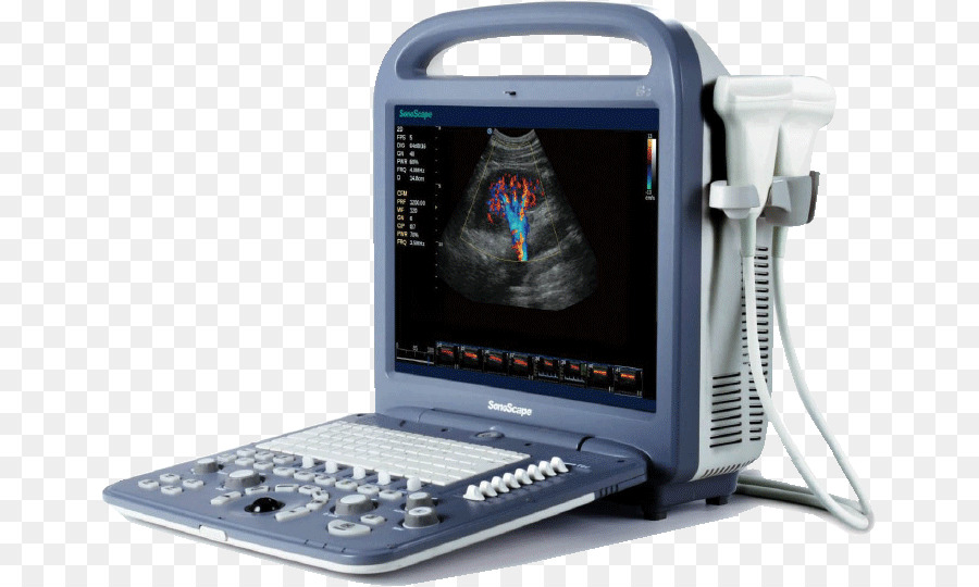 L échocardiographie Doppler，L échographie PNG