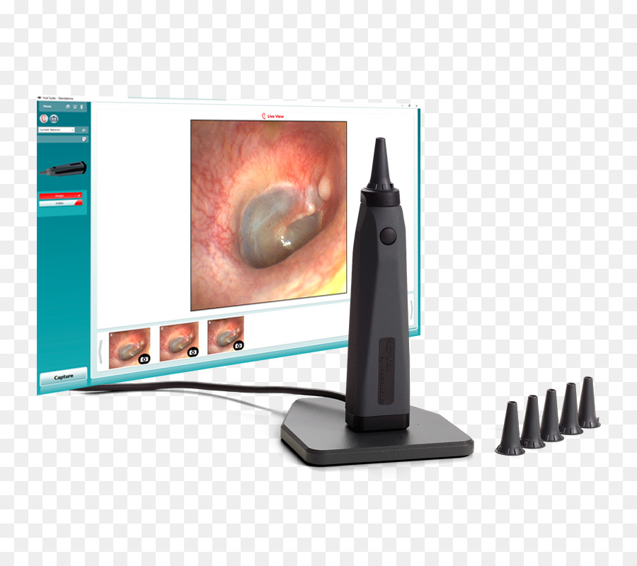 Otoscope，L Audiométrie PNG