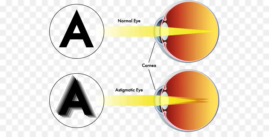 Астигматический глаз，Зрение PNG
