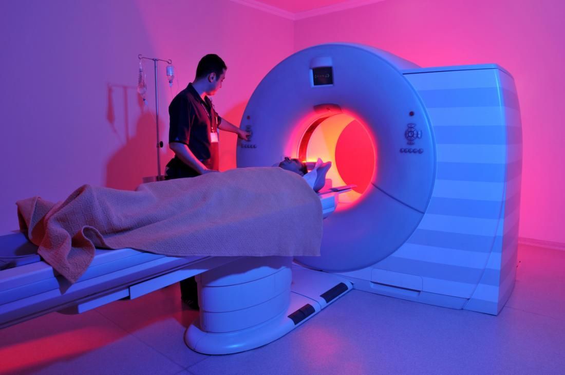 MRI Scans