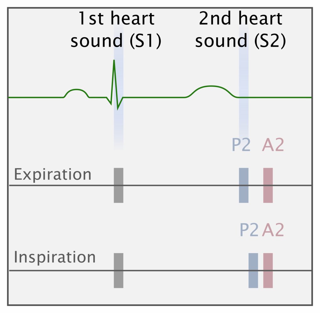 Normal Heart Beat Sound