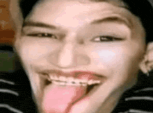 a man with braces is sticking his tongue out .