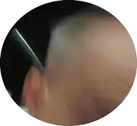 a close up of a person 's ear with a green object in the middle