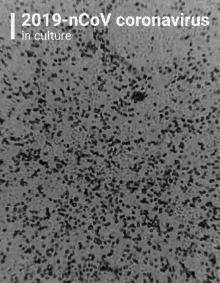 a black and white photo of a surface with the words 2019-ncov coronavirus in culture