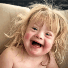 a little girl with down syndrome smiles with her mouth open