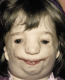 a close up of a child 's face with a missing nose and mouth .