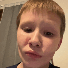 a young boy with a red spot on his nose looks at the camera