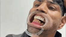 a man with a mouth open and a mouth guard on his teeth .