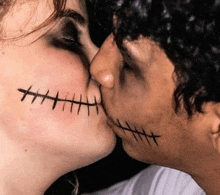 a man is kissing a woman with stitches on her face .