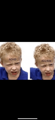 a boy with adhd and ad240p written on his forehead .