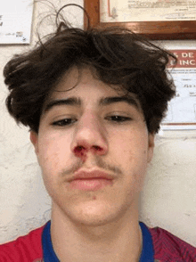 a young man with a bloody nose is wearing a red shirt and a blue collar .