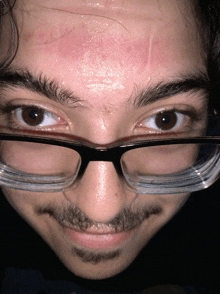 a close up of a man 's face with glasses and a red spot on his forehead