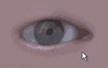 a close up of a person 's eye with an arrow pointing to the eye