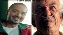 a picture of j balvin before and after drugs and a picture of an older man with a nasal cannula .