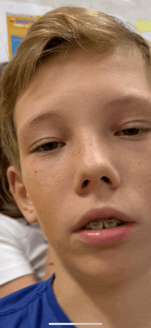 a young boy with braces on his teeth is looking at the camera