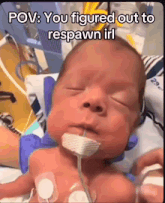 a baby is laying in a hospital bed with a hose around his neck .