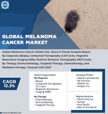 global melanoma cancer market size share & trends analysis report by diagnosis