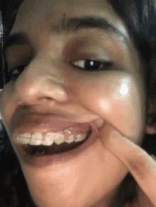 a woman with braces on her teeth is smiling and touching her face