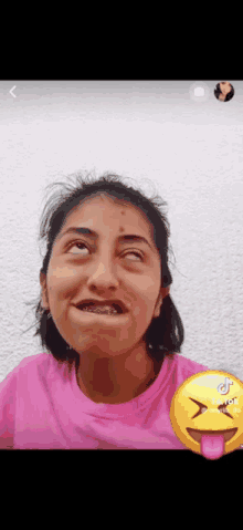 a girl with braces on her teeth making a funny face next to an emoji