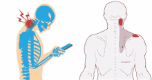 a drawing of a skeleton holding a cell phone next to a drawing of a man with a neck pain