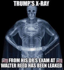 an x-ray of a skeleton dressed as superman with the caption trump 's x-ray