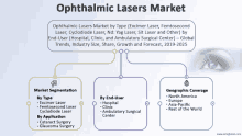 a diagram showing the ophthalmic lasers market by type and geographic coverage