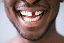 a man with a missing tooth is smiling