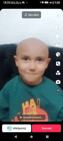 a phone screen shows a child with a bald head