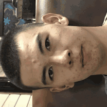 a close up of a young man 's face with a few spots on it