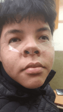 a close up of a young man 's face with a piece of plastic on his nose