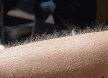 a close up of a person 's arm with a lot of hair .