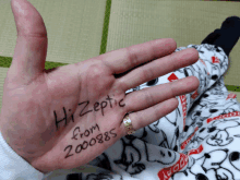 a hand with a ring on it says hi zeptic from 200085