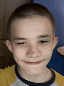 a young boy with a shaved head looks at the camera with a smile on his face