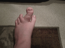 a close up of a person 's foot with a toe missing