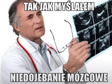 a doctor looking at a x-ray with a caption that says tak jak myslialem niedojebane mozgowe