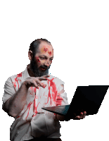 a man with blood on his face holding a laptop