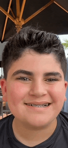 a young man with braces on his teeth is smiling .