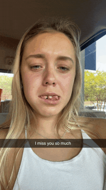 a woman with a missing tooth has a snapchat caption that says " i miss you so much "