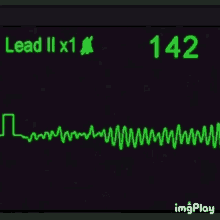 a monitor showing a heartbeat with the number 142