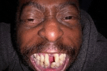 a close up of a man 's face with a beard and very ugly teeth .