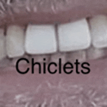 a close up of a person 's teeth with the word chiclets written on it .