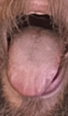 a close up of a person 's tongue sticking out with their mouth open .