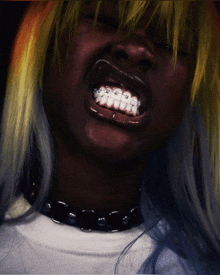 a woman with braces on her teeth is wearing a black choker