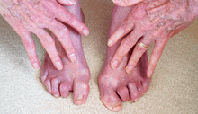 an elderly woman 's hands and feet are shown together