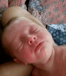 a baby is sleeping on a bed with his eyes closed and his face is covered in red spots .