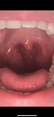 a close up of a person 's mouth with teeth and a tongue sticking out