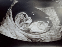 a black and white ultrasound image of a baby with the numbers c24-0